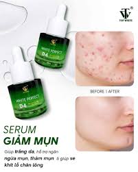 Top White White Perfect D4 Prevent Acne Serum Essence Acne Serum