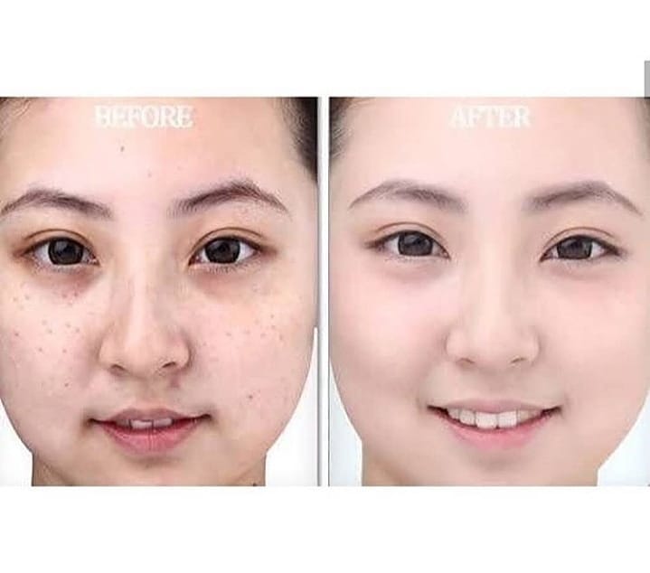 Shiseido Pure White Skin Whitening Supplement 240 Tablets