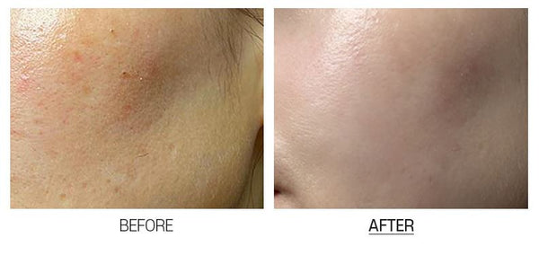 medi peel glutathione 600 MEDI-PEEL BIO-INTENSE GLUTATHIONE WHITE CREAM 50 g – Damode USA medi peel glutathione 600 MEDI-PEEL BIO-INTENSE GLUTATHIONE WHITE CREAM 50 g – Damode USA