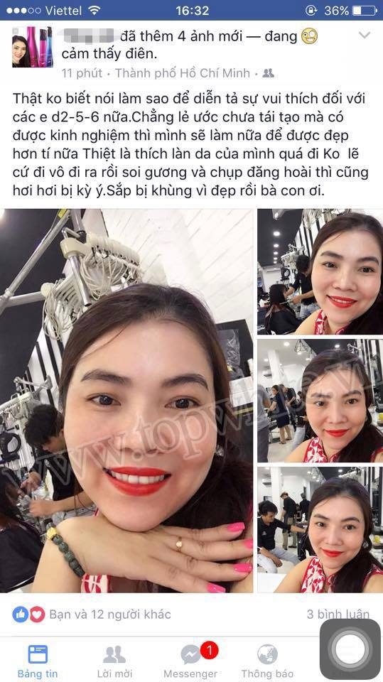 TOP WHITE WHITE PERFECT D6 SERUM ESSENCE TINH CHẤT TẠO SỰ CĂNG BÓNG TRẺ HÓA LÀN DA