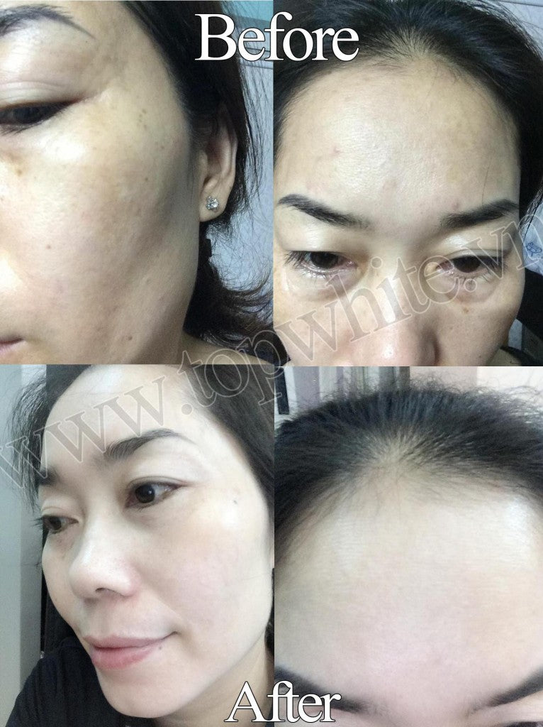 TOP WHITE WHITE PERFECT D2 : RECONDITION CREAM, RESTORE THE SKIN AT NIGHT