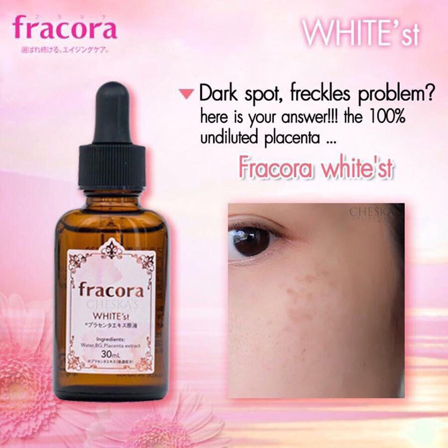Fracora White'st Pure Placenta Extract Beauty Serum 30ml Japan Skin Care