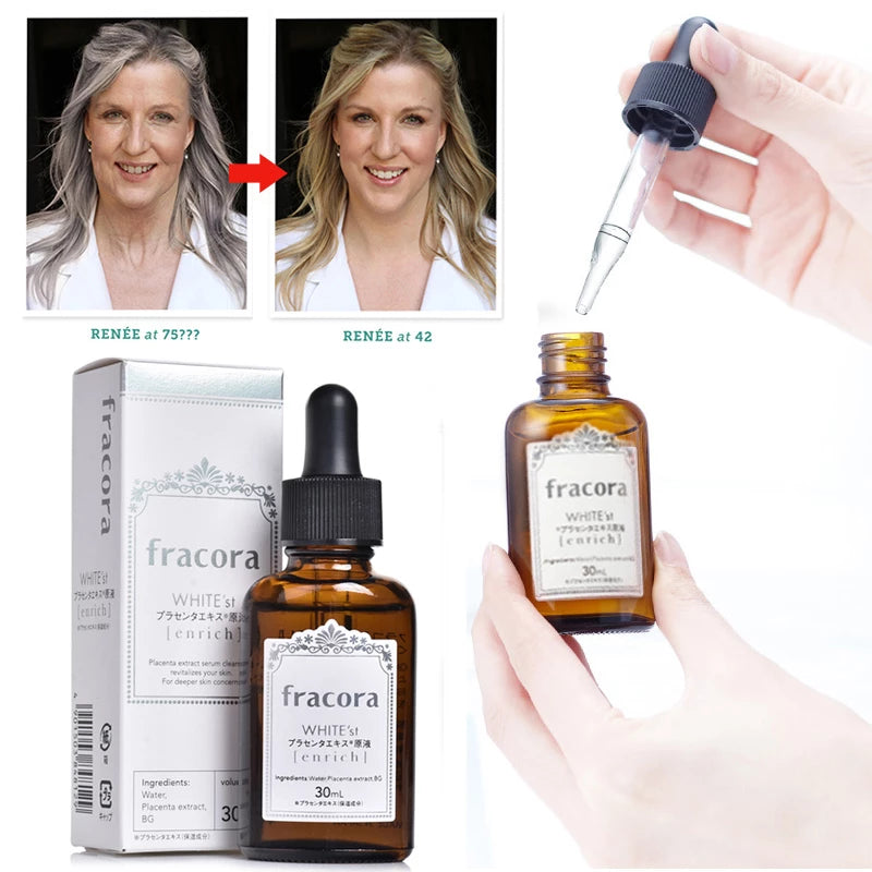 Fracora White'st Pure Placenta Extract Beauty Serum 30ml Japan Skin Care