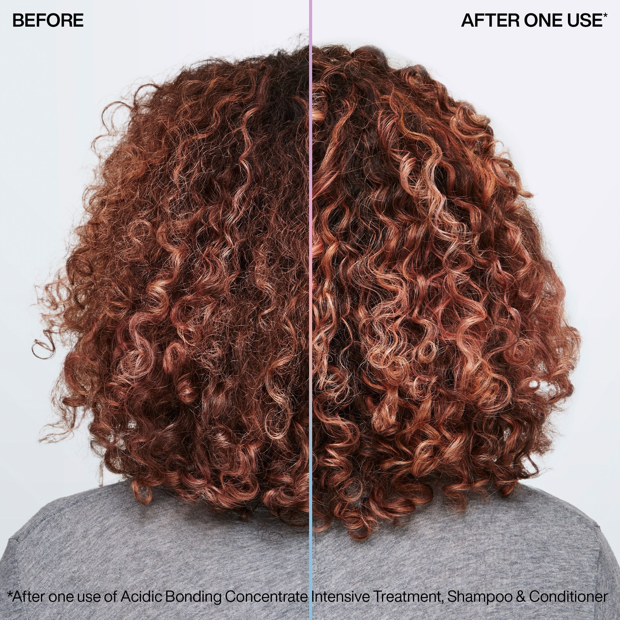 Redken ACIDIC BONDING CONCENTRATE INTENSIVE TREATMENT DAMAGED HAIR - 5.1 oz (Buy 2 Get 1 Free Mix & Match) (Buy 3 Get 1 Free Mix & Match)