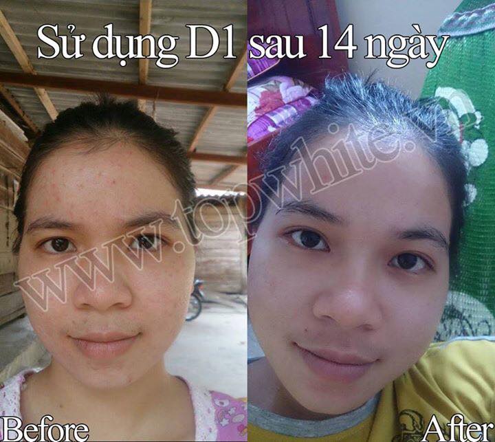 TOP WHITE WHITE PERFECT D2 : RECONDITION CREAM, RESTORE THE SKIN AT NIGHT