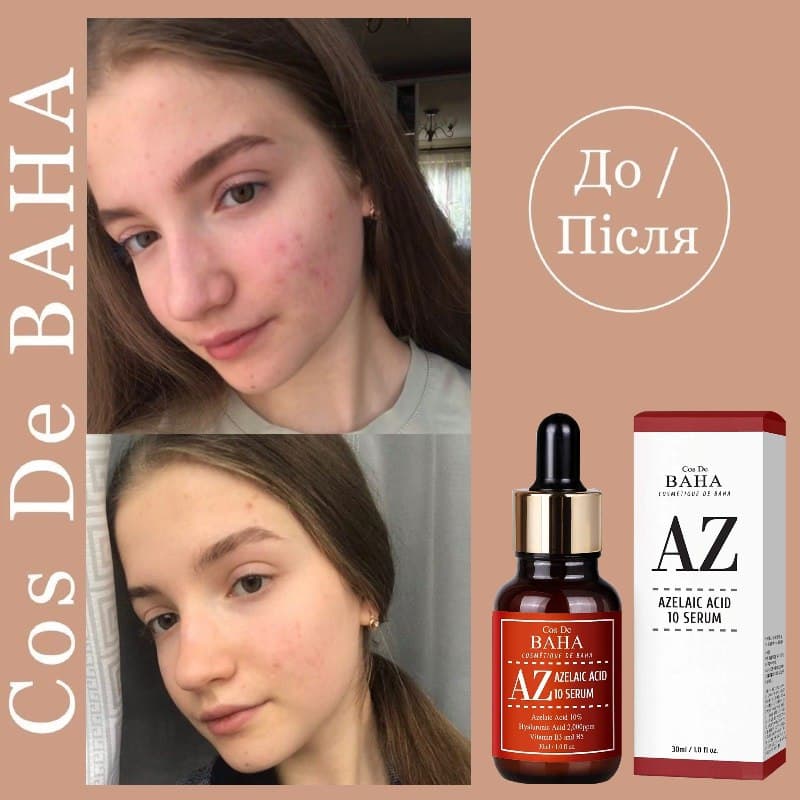 Cos De BAHA - AZ Azelaic Acid 10 Serum 30 ml