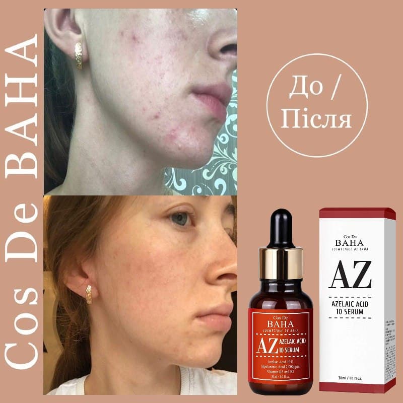 Cos De BAHA - AZ Azelaic Acid 10 Serum 30 ml