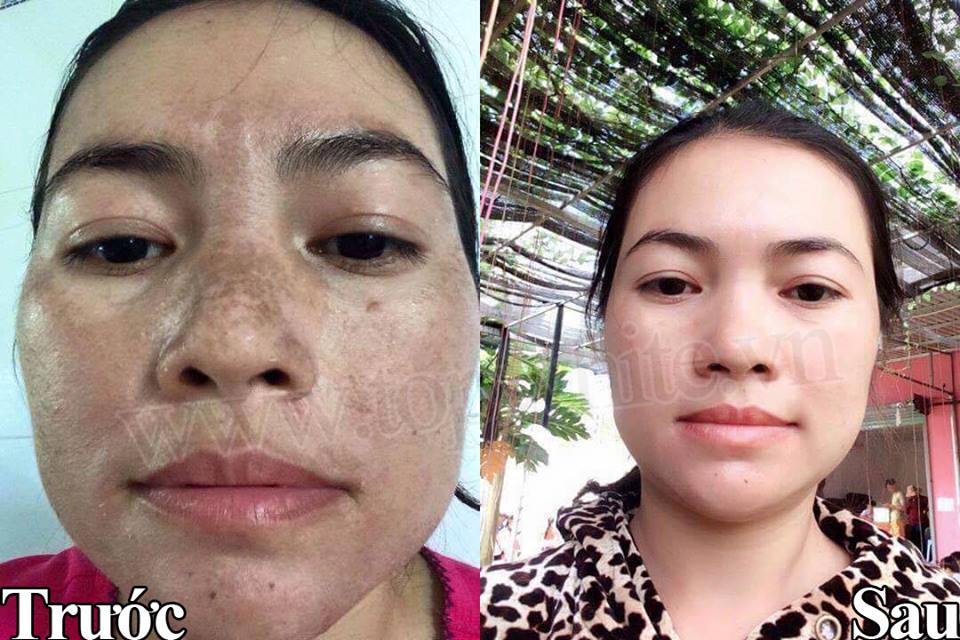 TOP WHITE WHITE PERFECT D2 : RECONDITION CREAM, RESTORE THE SKIN AT NIGHT