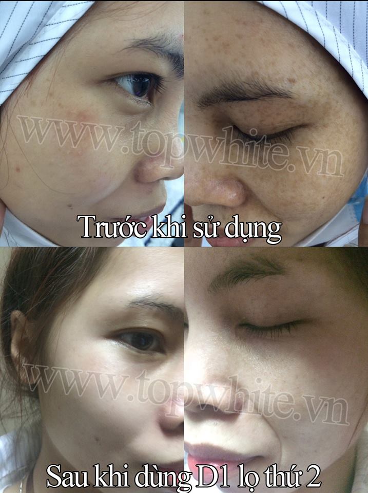 TOP WHITE WHITE PERFECT D2 : RECONDITION CREAM, RESTORE THE SKIN AT NIGHT