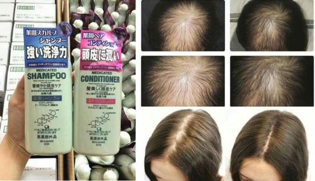 Kaminomoto Medicated Scalp Care Shampoo & Conditioner B&P 300ml Japan