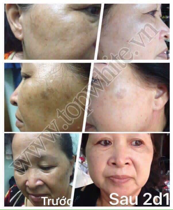 TOP WHITE WHITE PERFECT D2 : RECONDITION CREAM, RESTORE THE SKIN AT NIGHT