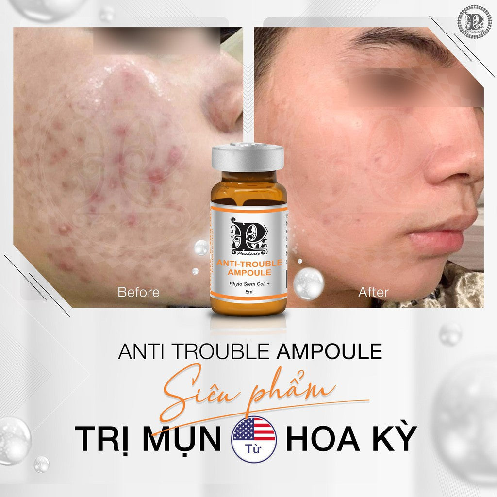 Mibiti Prudente Anti Trouble Ampoule 5ml