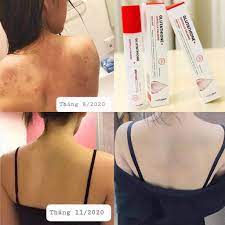 Angel's Liquid Glutathione Plus Centella Calming Body Mist 150 ml