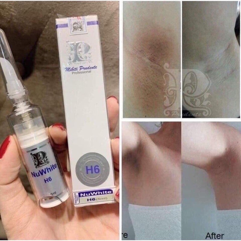 NUWHITE H6 Mibiti Prudente Brightening Skin Cream Dark Spot 5ml