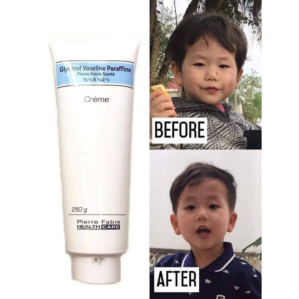 Glycerol Vaseline Paraffin, Pierre Fabre Santé, 15% / 8% / 2%