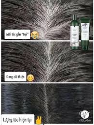 Weilaiya Ginger Shampoo 400 ml & Conditioner 250 ml Set