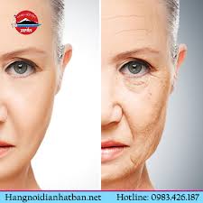 Lamelux Collagen 100,000 mg