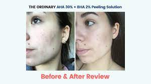 The Ordinary AHA 30% + BHA 2% Exfoliating Peeling Solution 30 ml