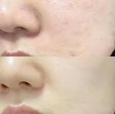 Paula's Choice 2% BHA Liquid Exfoliant 30ml