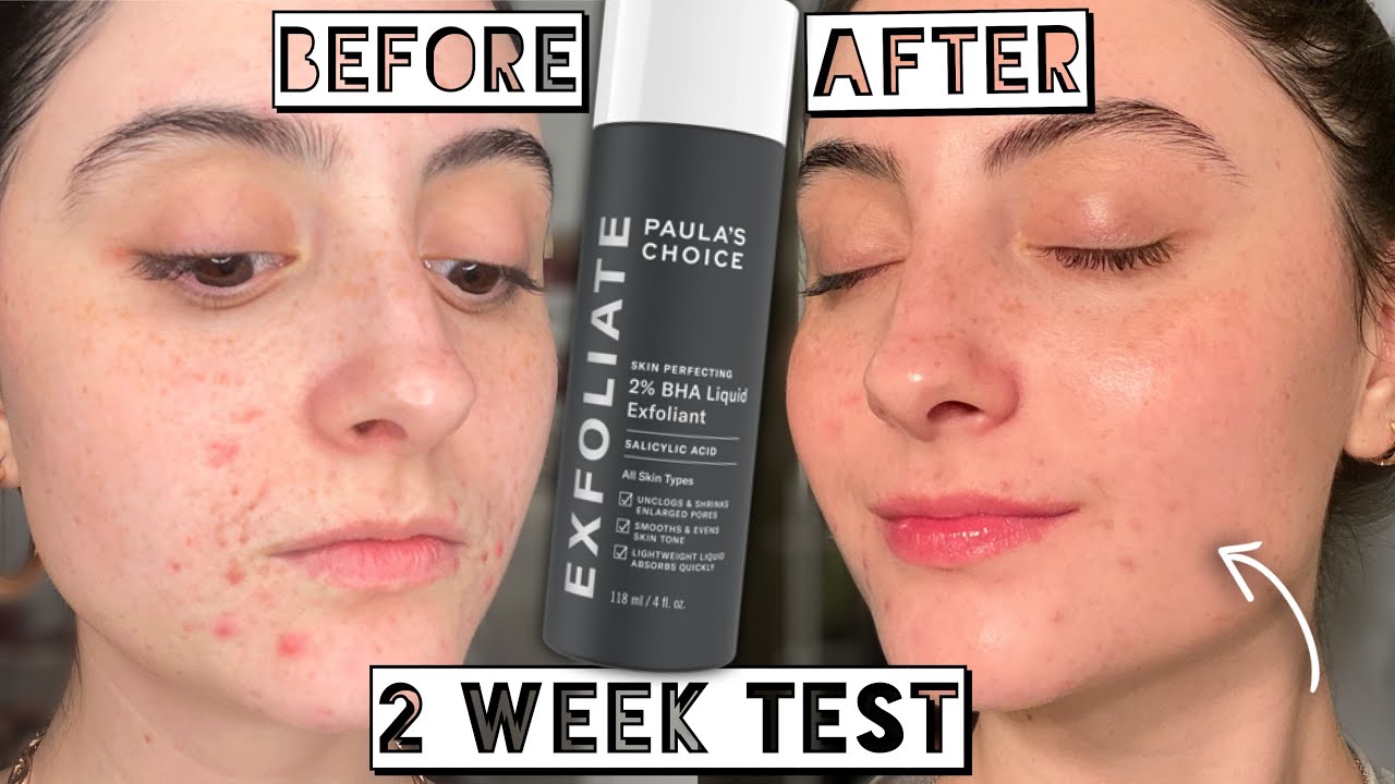 Paula's Choice 2% BHA Liquid Exfoliant 30ml