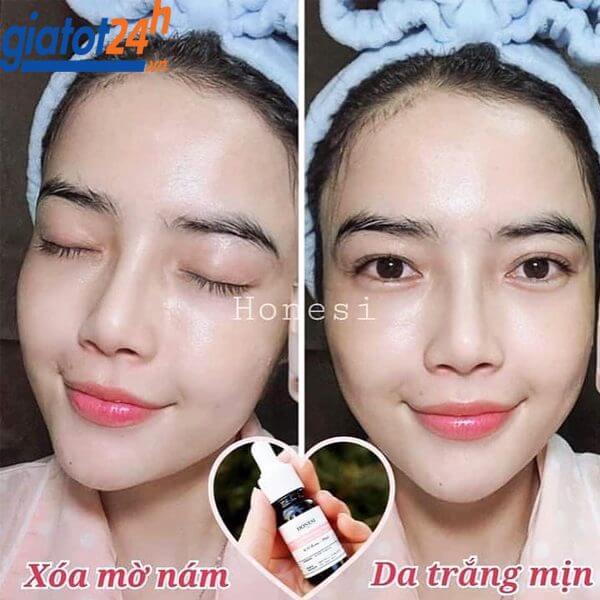 Honesi Vita Peel Brightening Ampoule 10 ml x 5 pcs