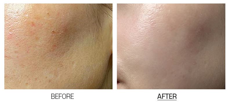 MEDI-PEEL BIO-INTENSE GLUTATHIONE WHITE CREAM 50 g Damode USA MEDI-PEEL BIO-INTENSE GLUTATHIONE WHITE CREAM 50 g Damode USA