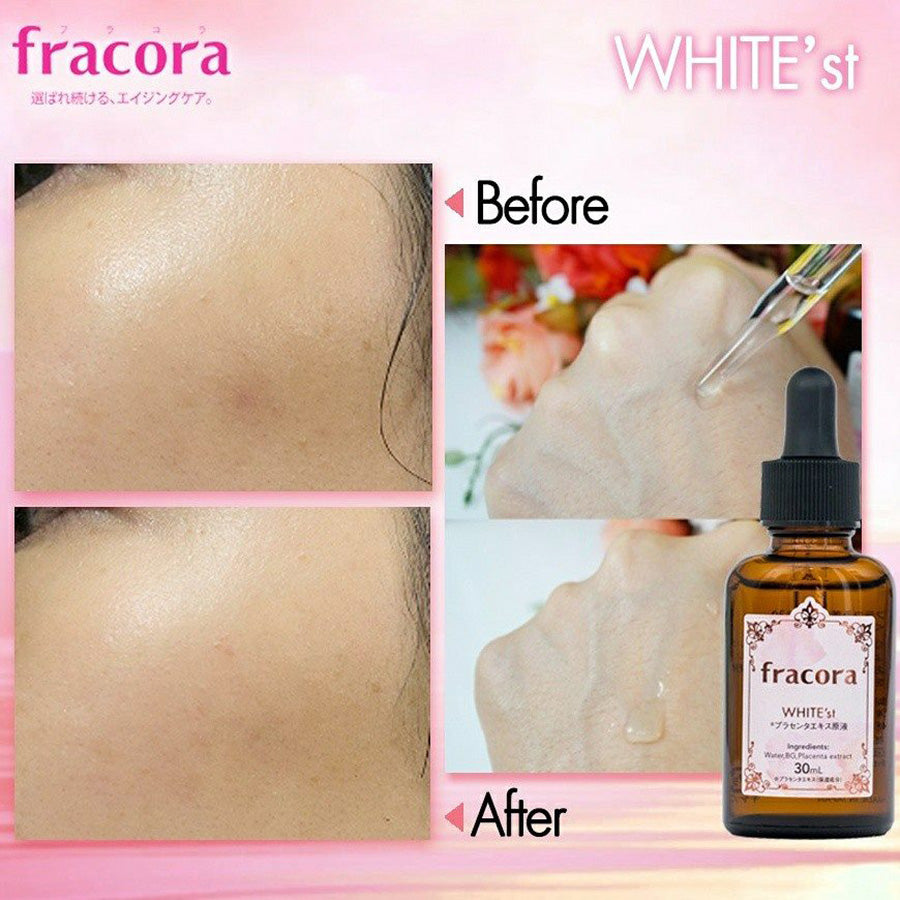 Fracora White'st Pure Placenta Extract Beauty Serum 30ml Japan Skin Care