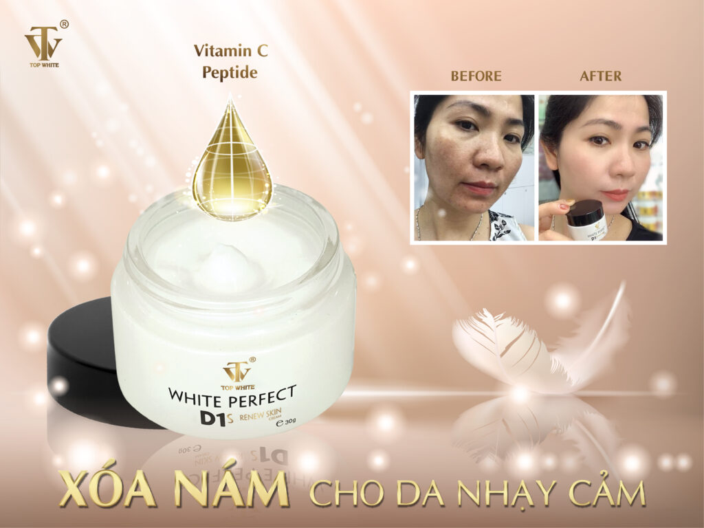 Top White White Perfect D1S Cream for melasma, freckles, age spots for sensitive skin