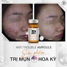 Mibiti Prudente Anti Trouble Ampoule 5ml