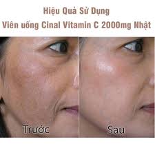 Vitamin Cinal C 100 capsules Brightening Skin
